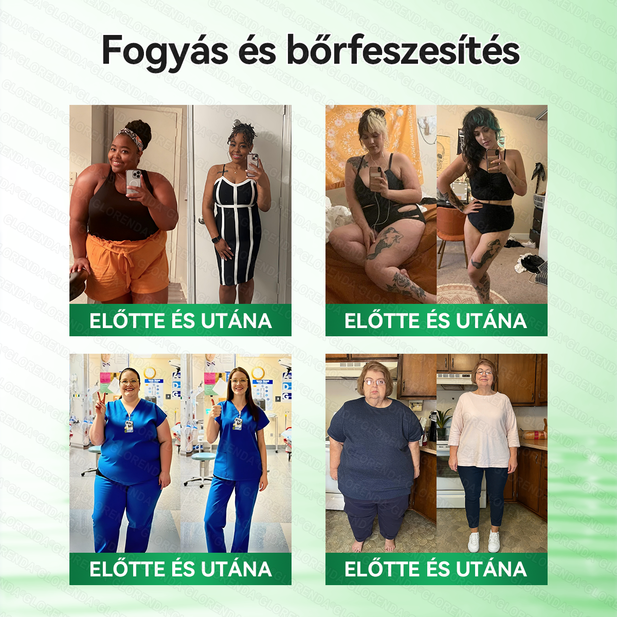 Hivatalos webáruház | 💎𝐆𝐋𝐎𝐑𝐄𝐍𝐃𝐀®  𝐅𝐞𝐣𝐥𝐞𝐭𝐭 𝐦𝐢𝐤𝐫𝐨𝐭ű𝐬 𝐧𝐚𝐧𝐨 𝐭𝐚𝐩𝐚𝐬𝐳 𝟏𝟎 𝐚𝐳 𝟏-𝐛𝐞𝐧 𝐟𝐨𝐫𝐦𝐮𝐥á𝐯𝐚𝐥（Naponta egyszeri használatra, látható eredményekkel akár már 7 nap után Azoknak, akik támogatni szeretnék testsúlyuk, bőrük és általános közérzetük egyensúlyát）